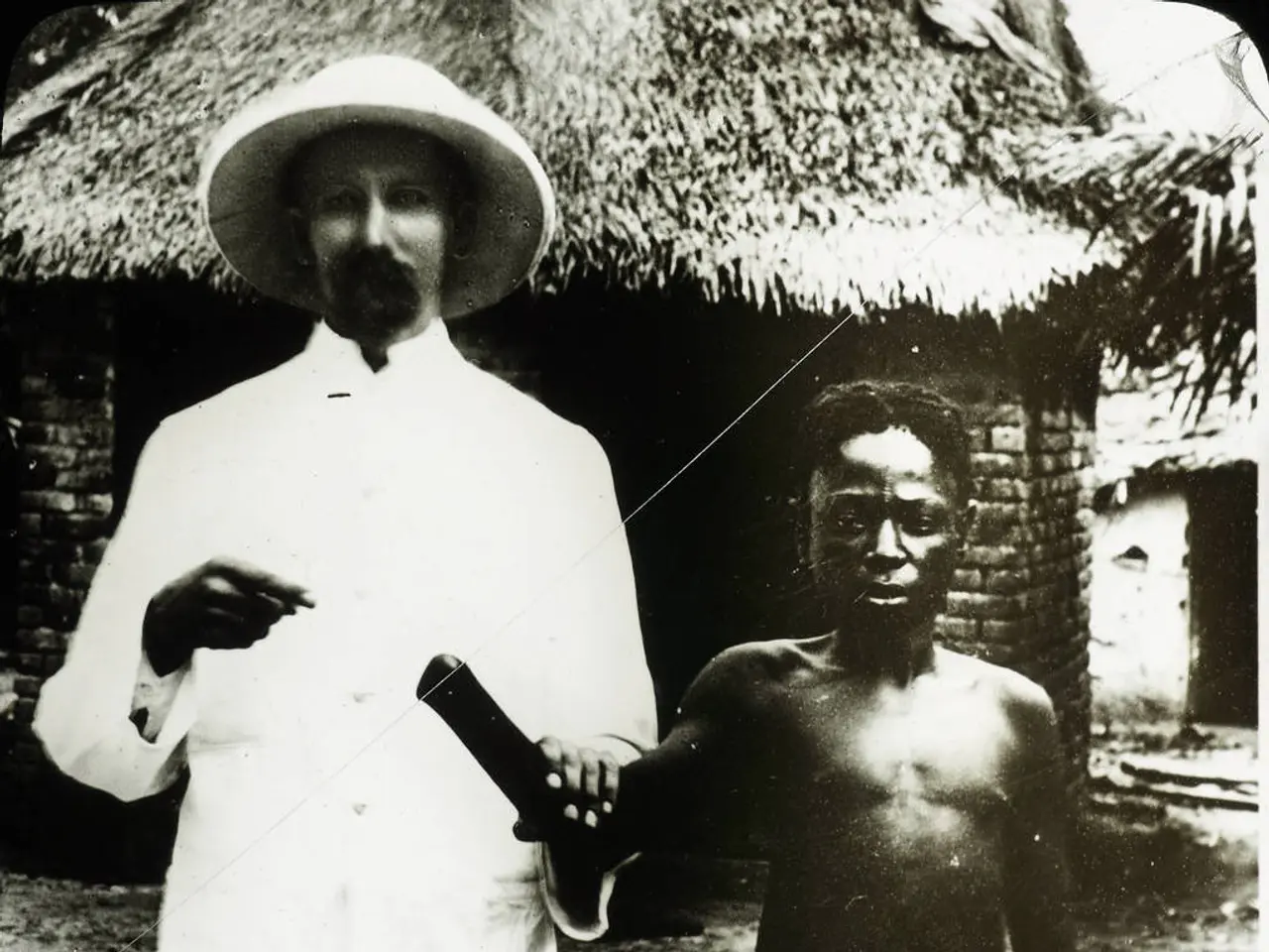 Rating System for Pain: Kinds, Levels, and Graph with Facial Expressions