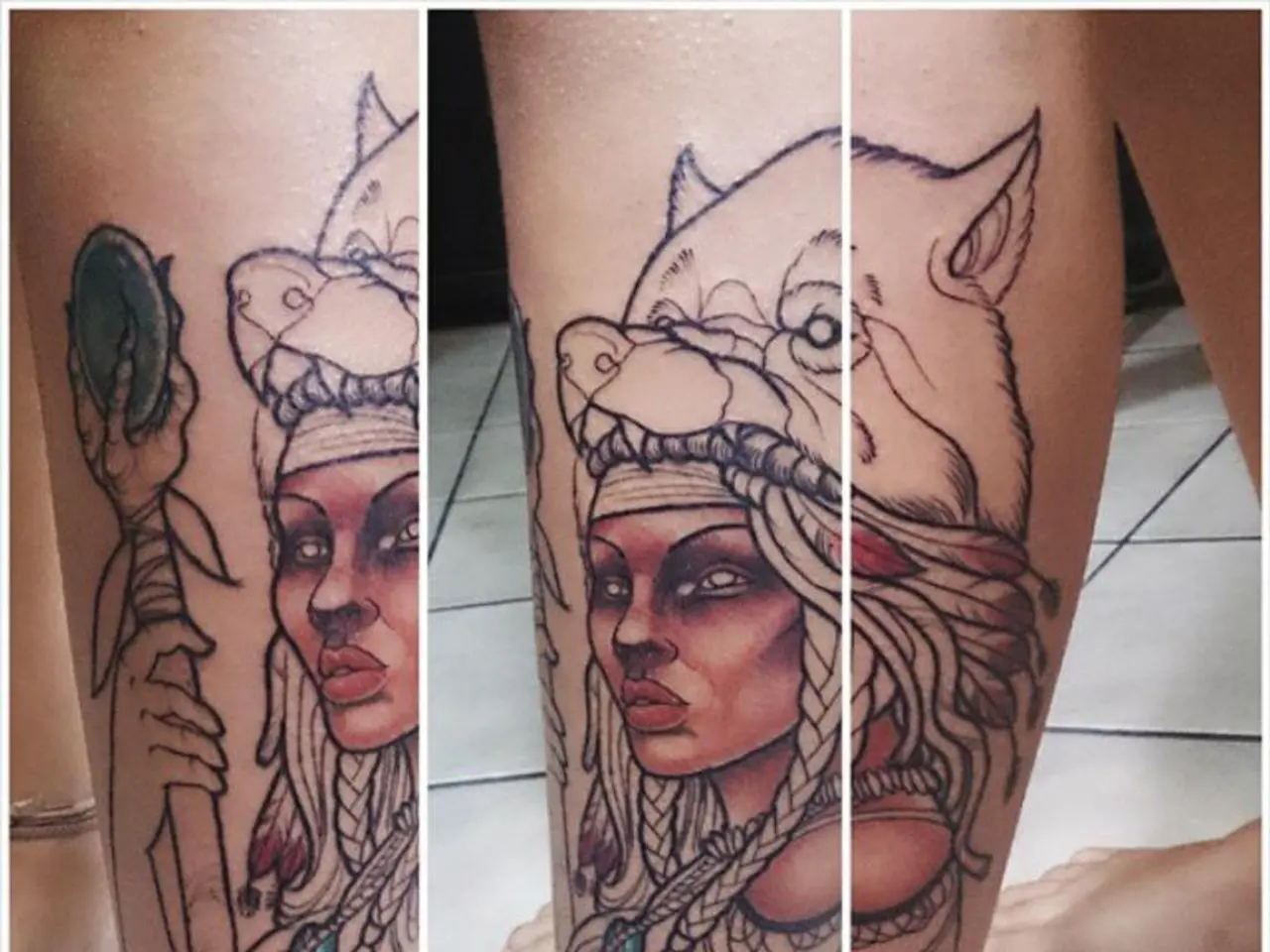 Genetic Disorder: Lifespan, Manifestations, and Origins - CdLS Syndrome