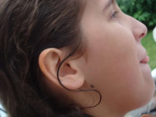 Disappearing Mole: Normal occurrence or cause for concern?