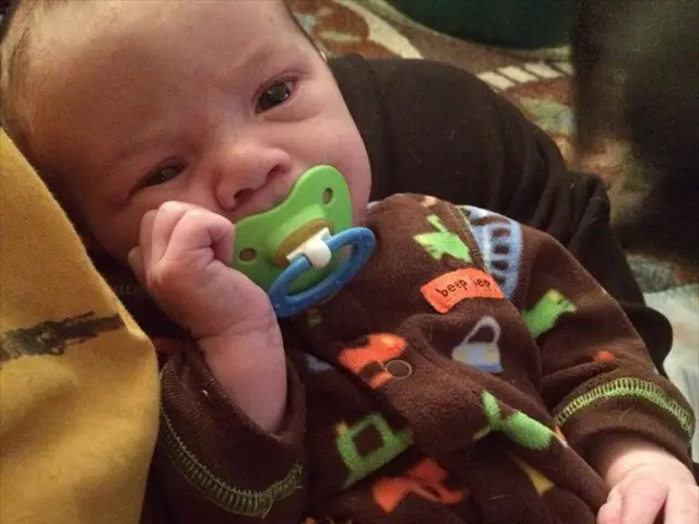 Nipple discomfort causes and solutions: Identifying symptoms, potential remedies, and further...