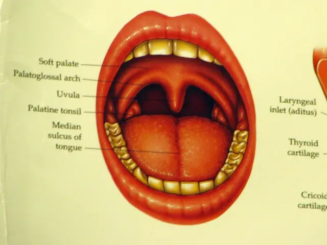 Dental fillings require replacement during a dental appointment.