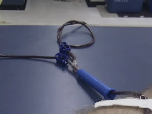 Husband turns out to be a 1-in-100,000 compatible kidney donor for his wife in California, in...