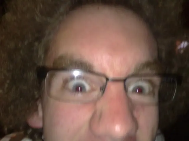 Sleeping with Contact Lenses: Potential Risks to Consider