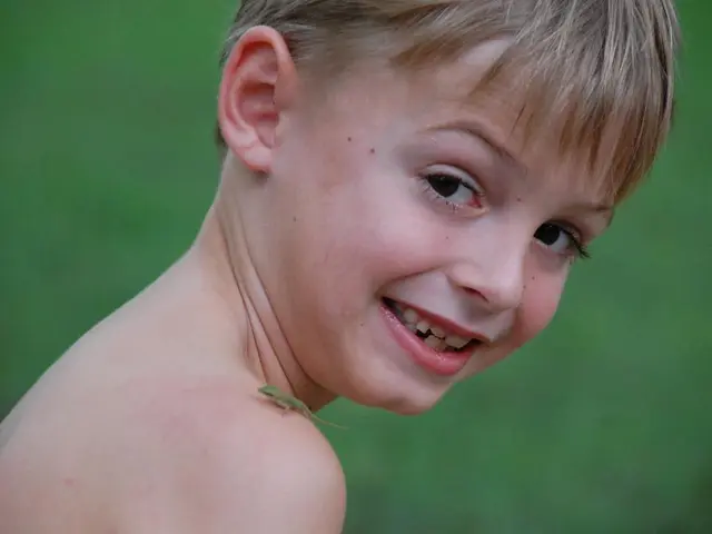 Uncommon Instance of Epidermoid Cyst in the Petrous Apex