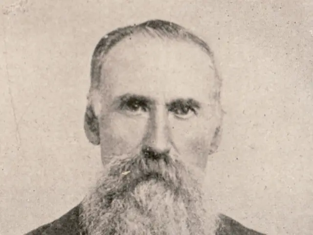 Solutions for Hairlessness in Beards: Filling Up Patchy Facial Hair